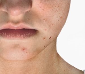 Les aspects des boutons sur la personne de la photo leur nom