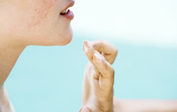 Sonnencreme bei Akne