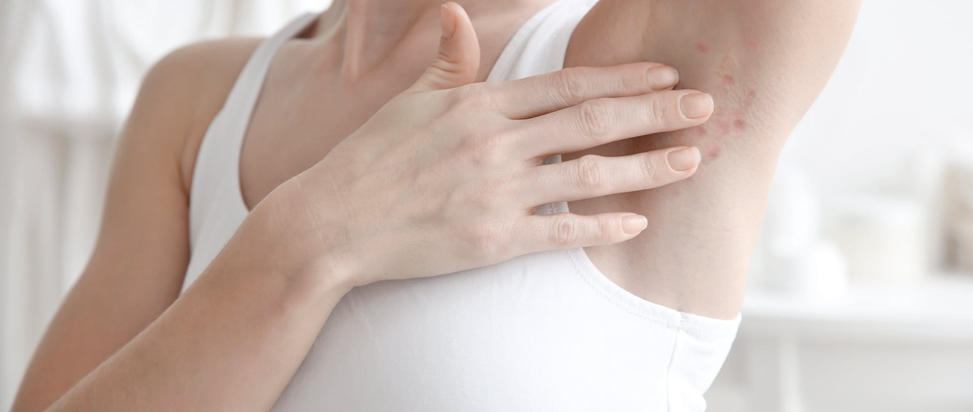 Acne Inversa Symptome Erkennen Und Behandeln Eucerin
