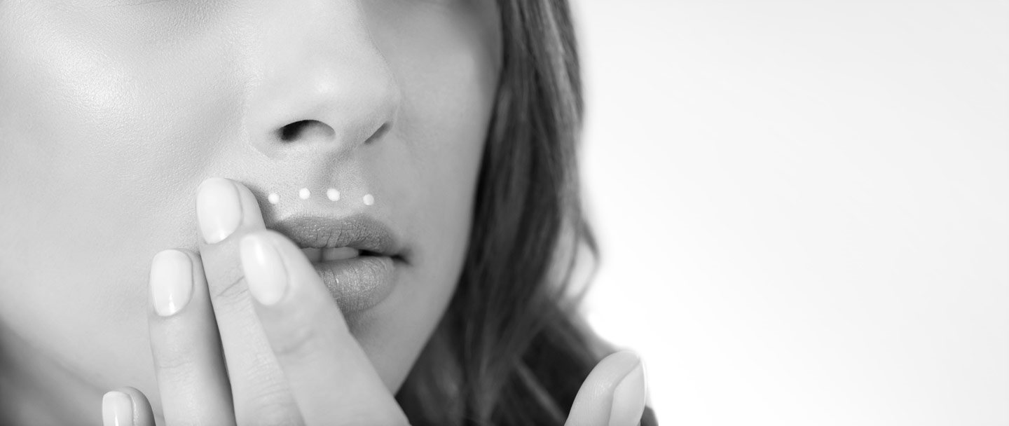 Gesicht einer Frau mit Melasma