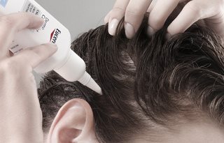 Schuppen Kopf Schuppen Kopf