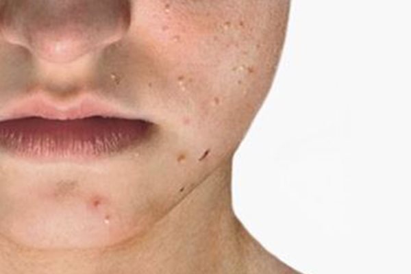Gesichtsreinigung Selber Machen Mit Natrlichen Zutaten Gesichtsreinigung Selber Machen Mit Natrlichen Zutaten