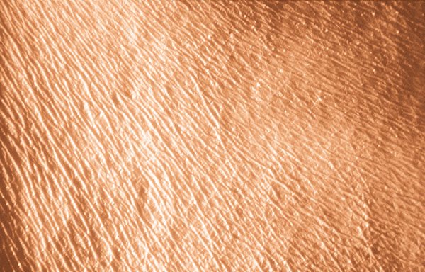 Photoaging: Hautalterung durch Sonne