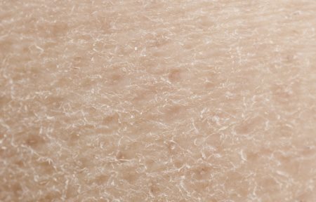 Nahaufnahme von sehr trockener Haut im Gesicht