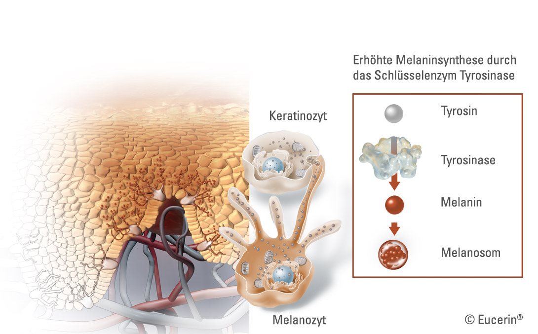 Darstellung der Pigmentierung der Haut