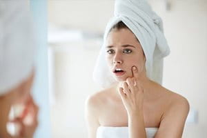Produkte gegen unreine Haut | Eucerin