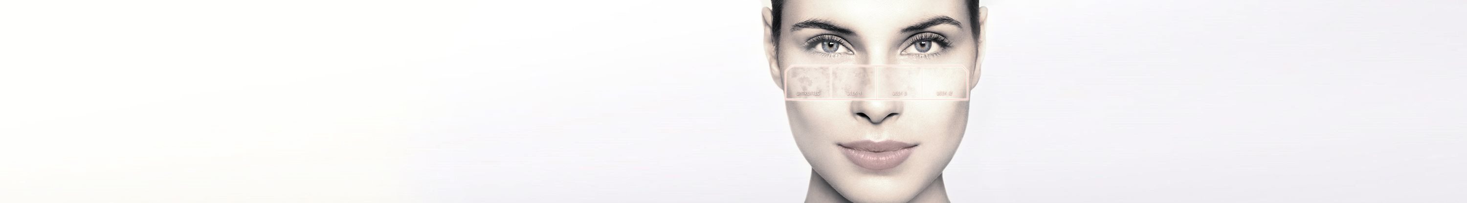 Entwicklung der Hyperpigmentierung während der Behandlung auf Frauenhaut